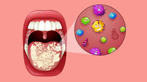 best probiotics for bad breath