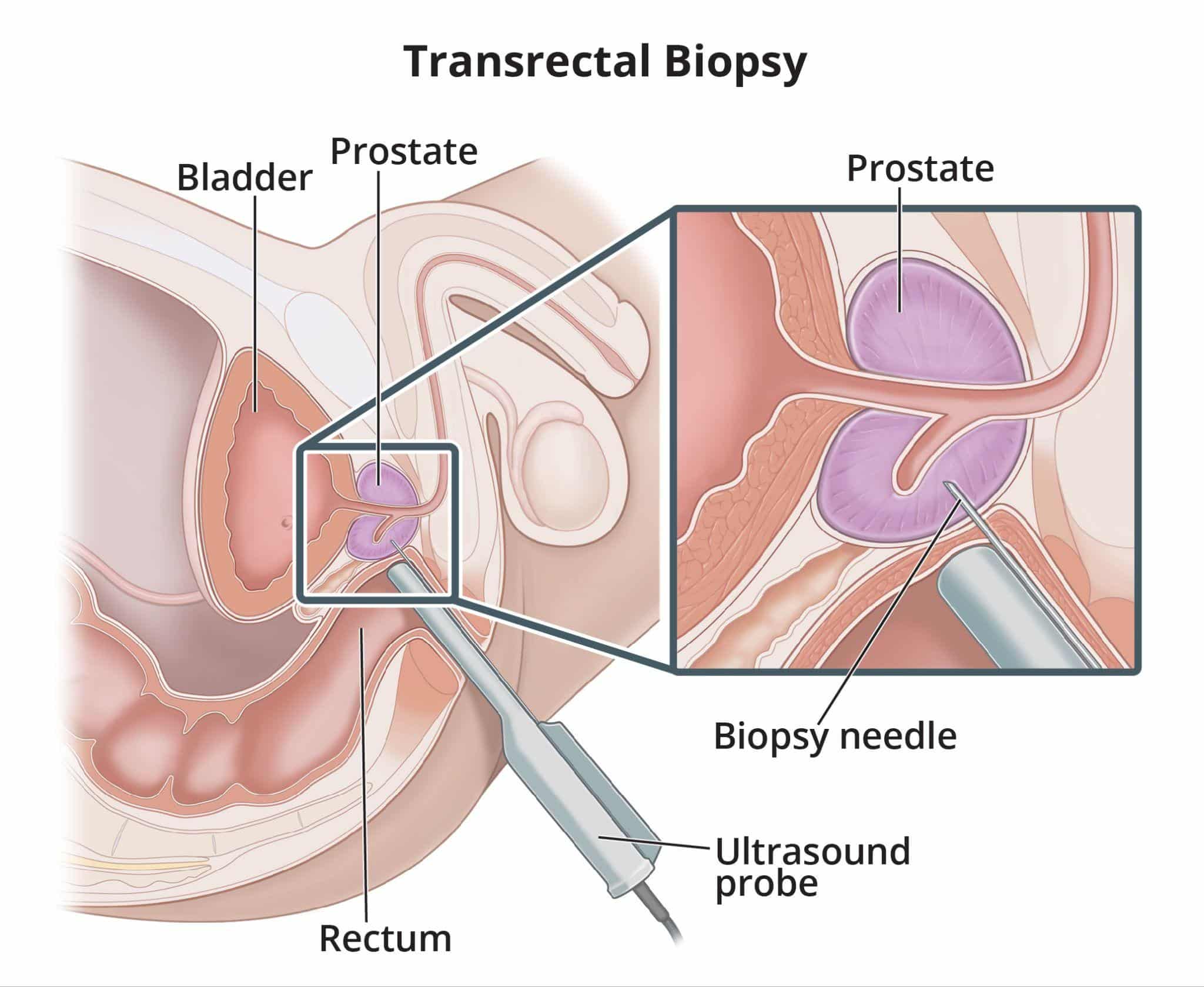 At-Home Prostate Massage Tips